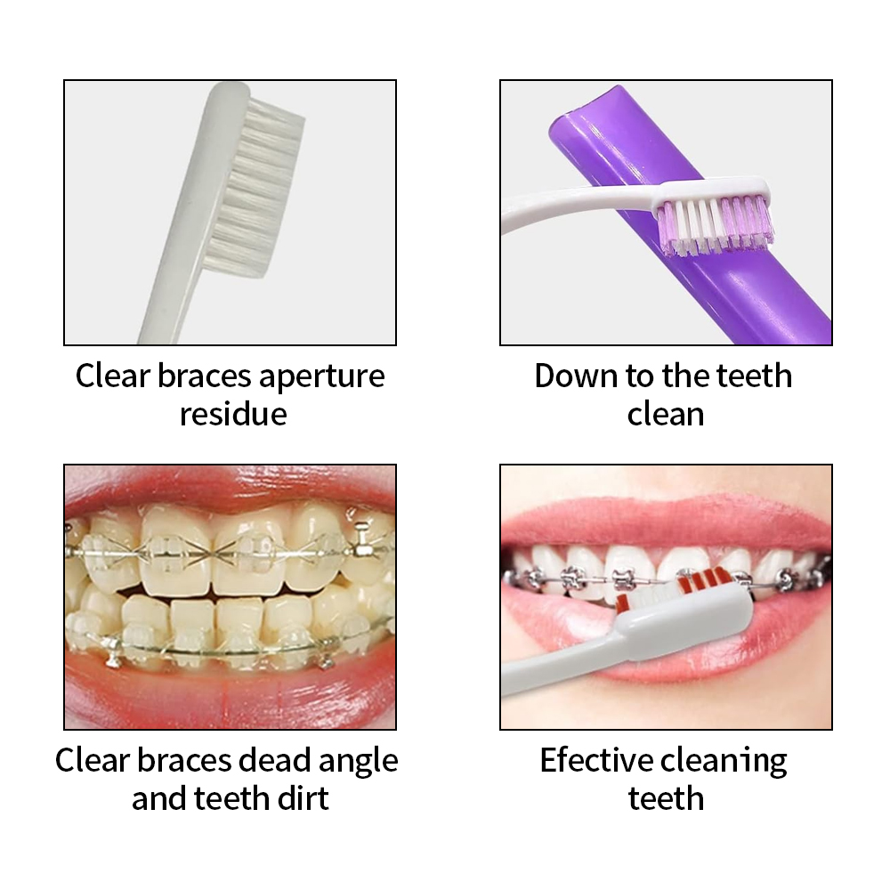 8 unids/set Kit de cepillo de  - Teeth Whitening For Braces reseña y precio