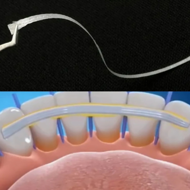 1/5 unidades de tiras de fibra - Teeth Whitening Strips Lumineux reseña y precio