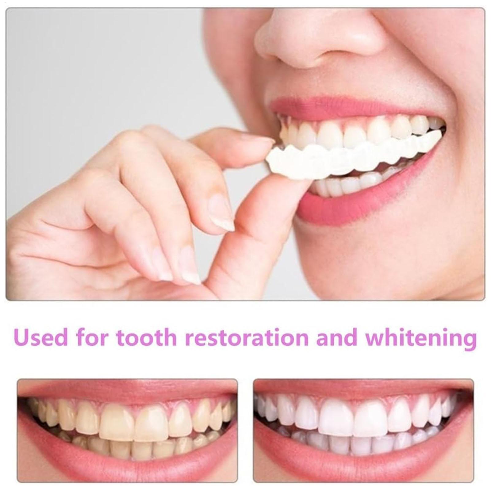 Cubiertas Dentales Superiores  - Teeth Whitening For Braces reseña y precio