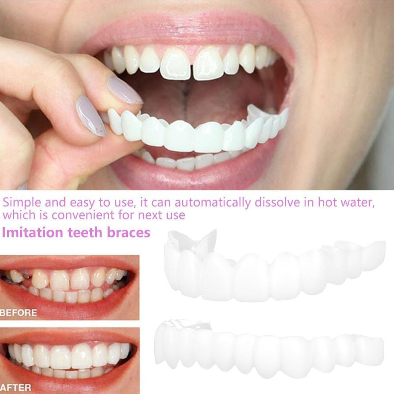 Cubiertas Dentales Superiores  - Teeth Whitening For Braces reseña y precio