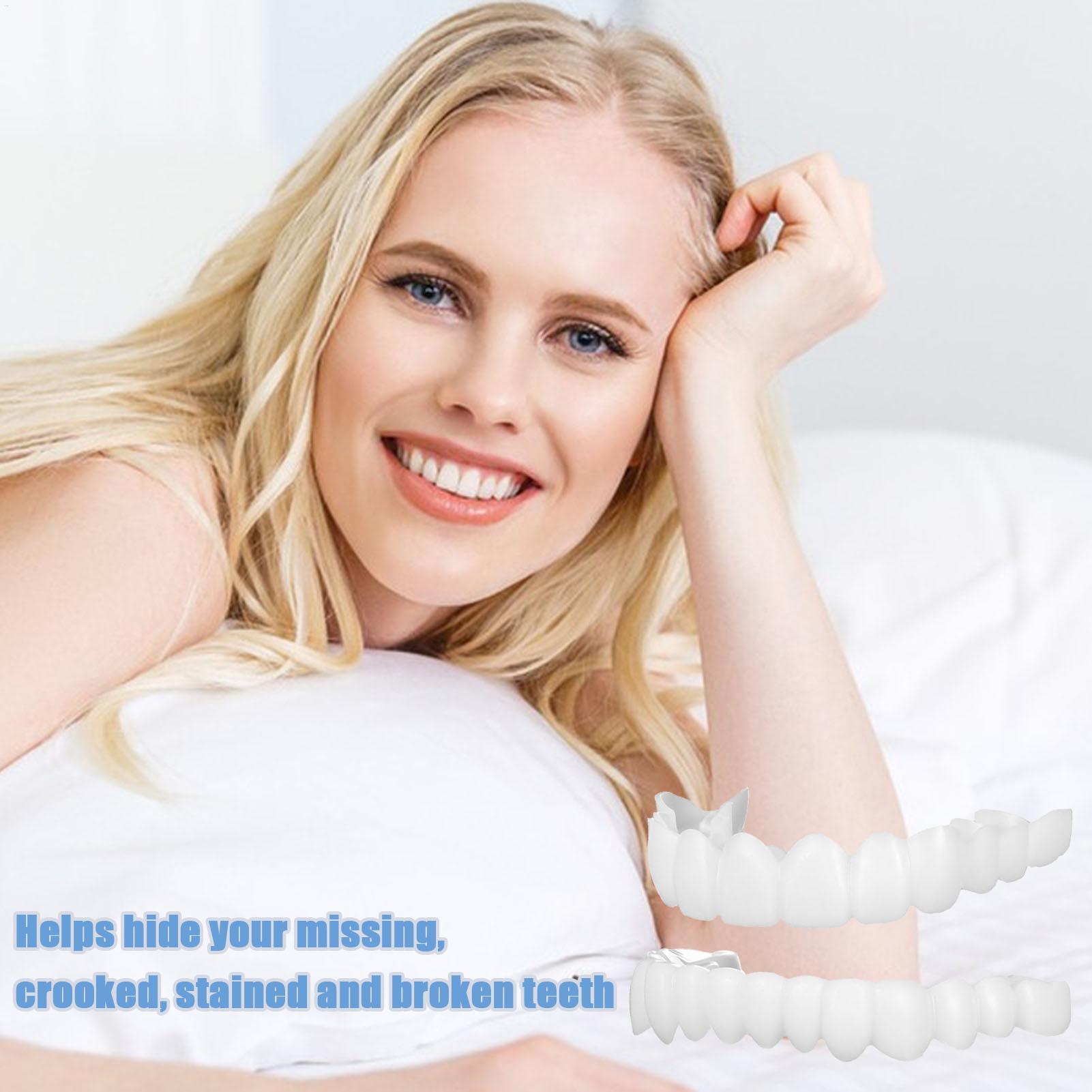 Cubiertas Dentales Superiores  - Teeth Whitening For Braces reseña y precio