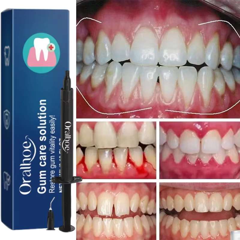 Gel Blanqueador Dental, Repara - Teeth Whitening Gels reseña y precio