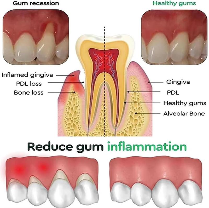 Gel Blanqueador Dental, Repara - Teeth Whitening Gels reseña y precio