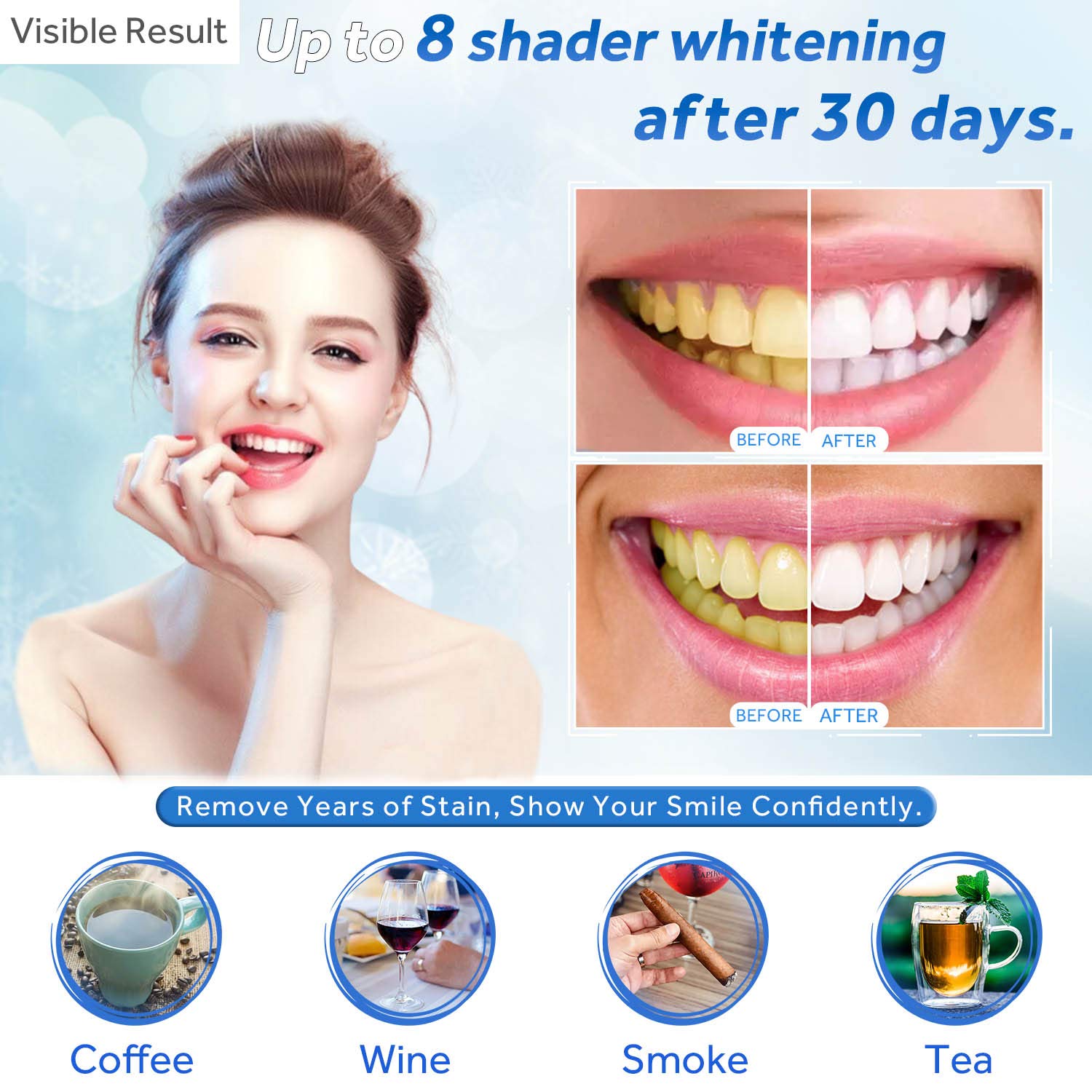 Jeringa de repuesto de Gel par - Teeth Whitening Singapore reseña y precio