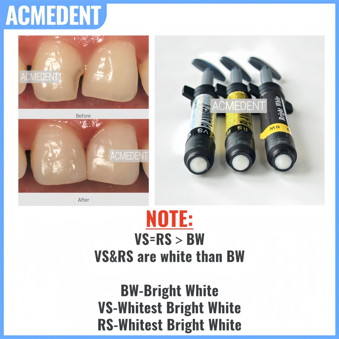 Chapa de resina compuesta Dent - Teeth Whitening Vs Veneers reseña y precio