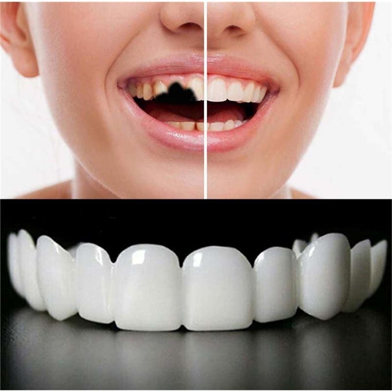 ¡NUEVO! ABMK】 2 Pares, Recuper - Teeth Whitening For Braces reseña y precio