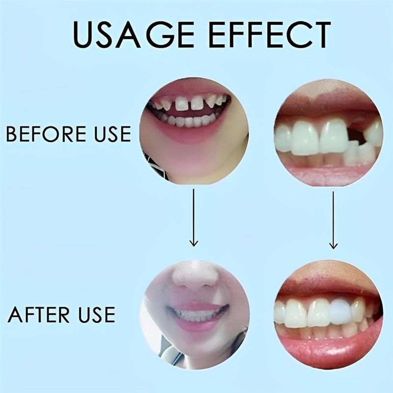 ¡NUEVO! ABMK】 2 Pares, Recuper - Teeth Whitening For Braces reseña y precio