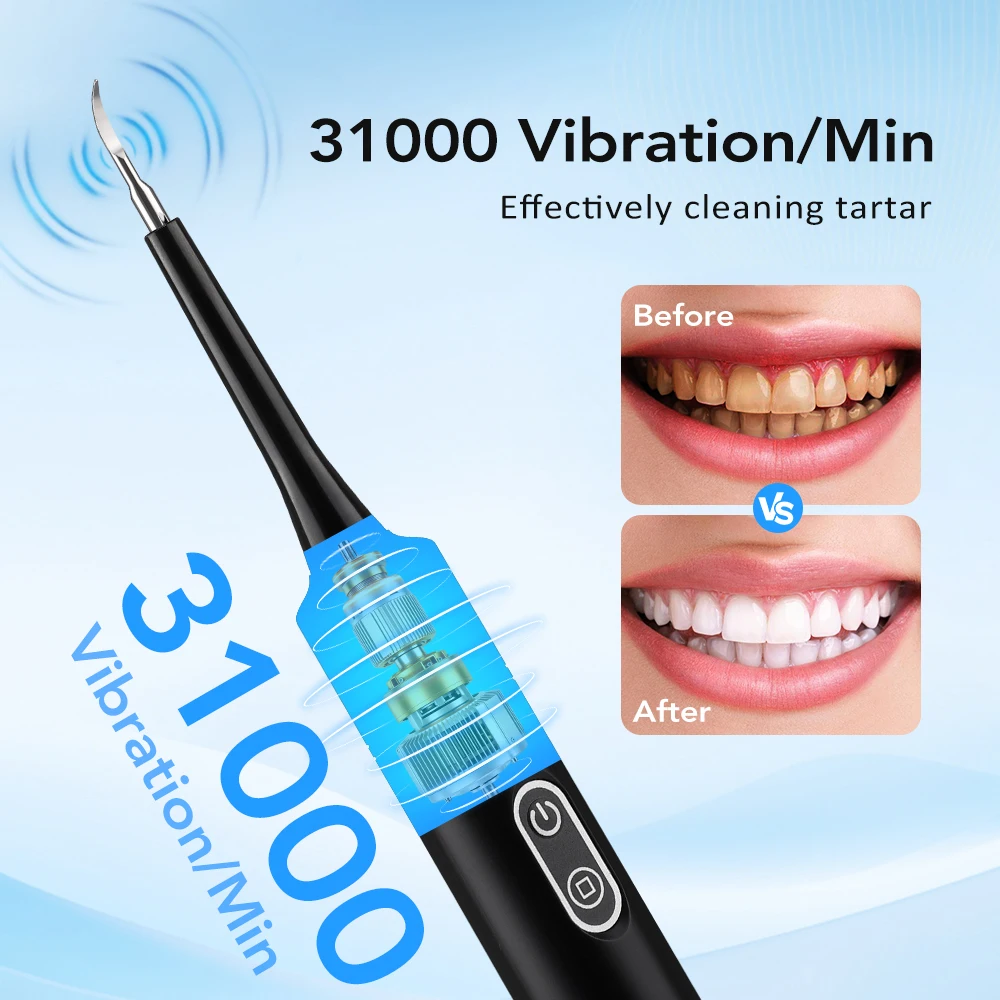 Limpiador Dental Eléctrico con - Teeth Whitening Professional reseña y precio